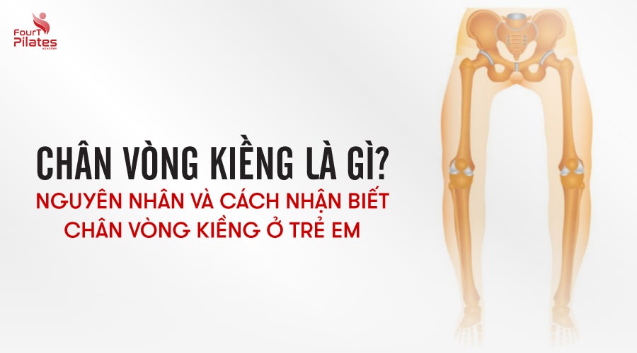 Chân vòng kiềng là gì? Nguyên nhân và cách nhận biết chân vòng kiềng ở trẻ em