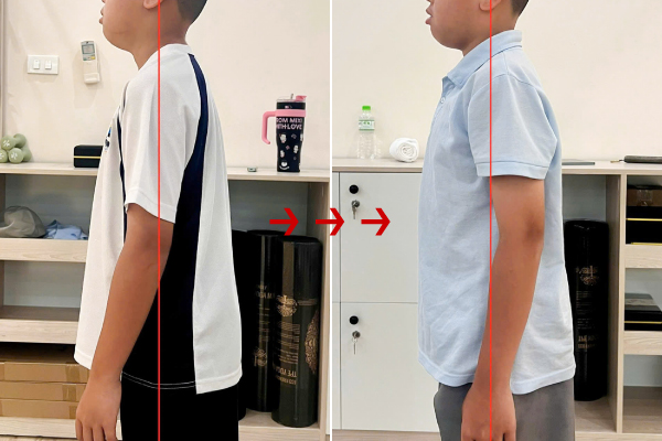 Câu chuyện chỉnh dáng của bé Quang tại FourT Pilates