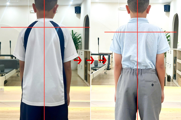 Sự thay đổi rõ rệt sau 80 buổi Pilates Kids